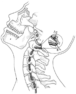 [Regulate Manual Therapy]